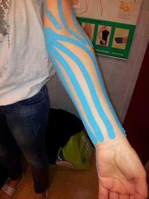 K-Taping bras thermes luz st sauveur